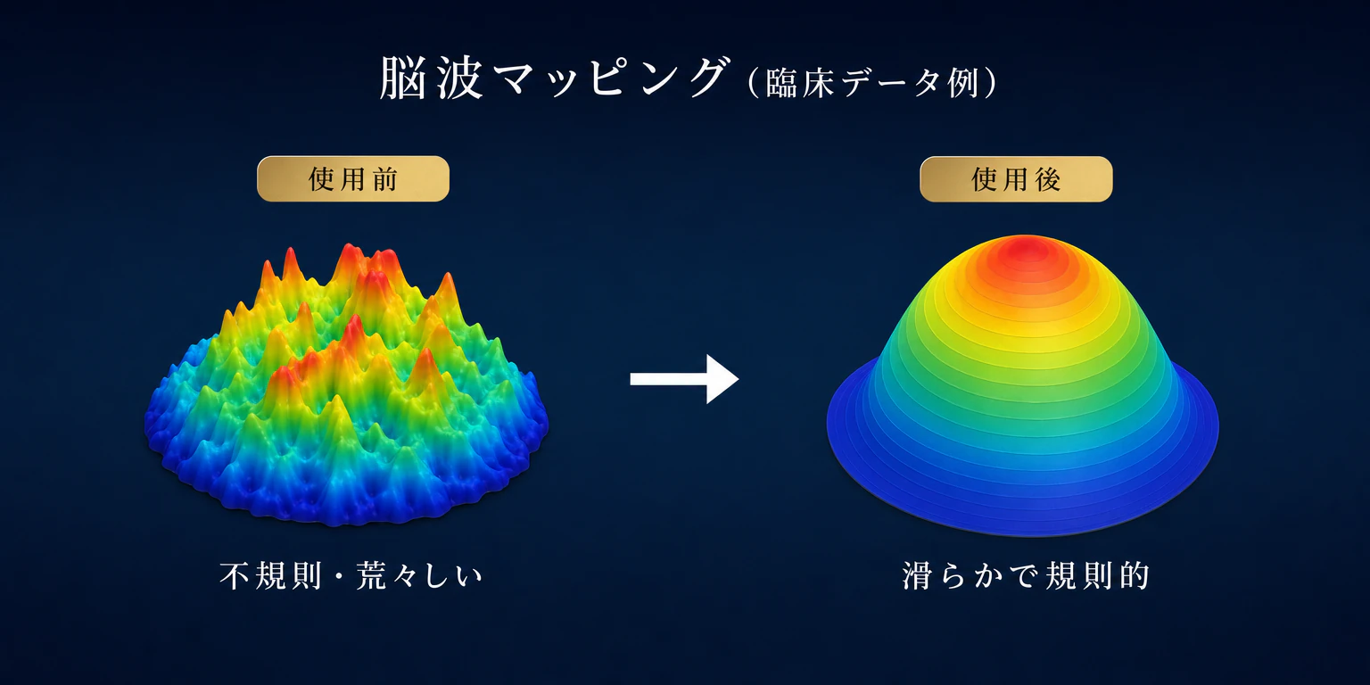 脳波マッピングの臨床データ例。使用前は不規則で荒々しく、使用後は滑らかで規則的